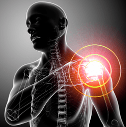 Symptômes d'arthrose